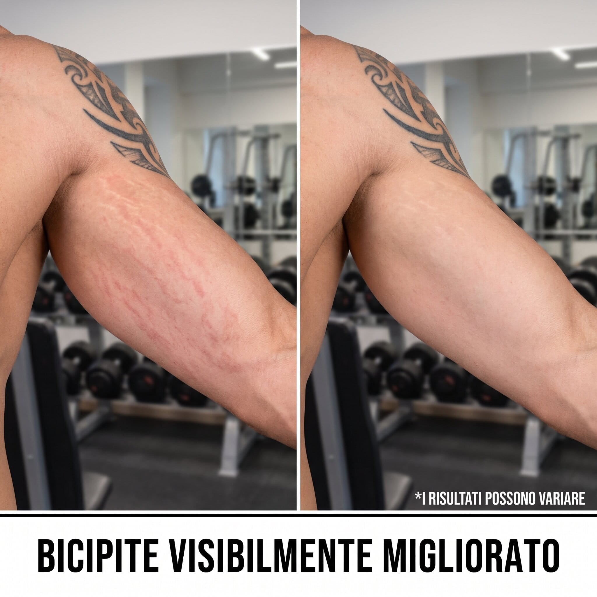Siero anti smagliature